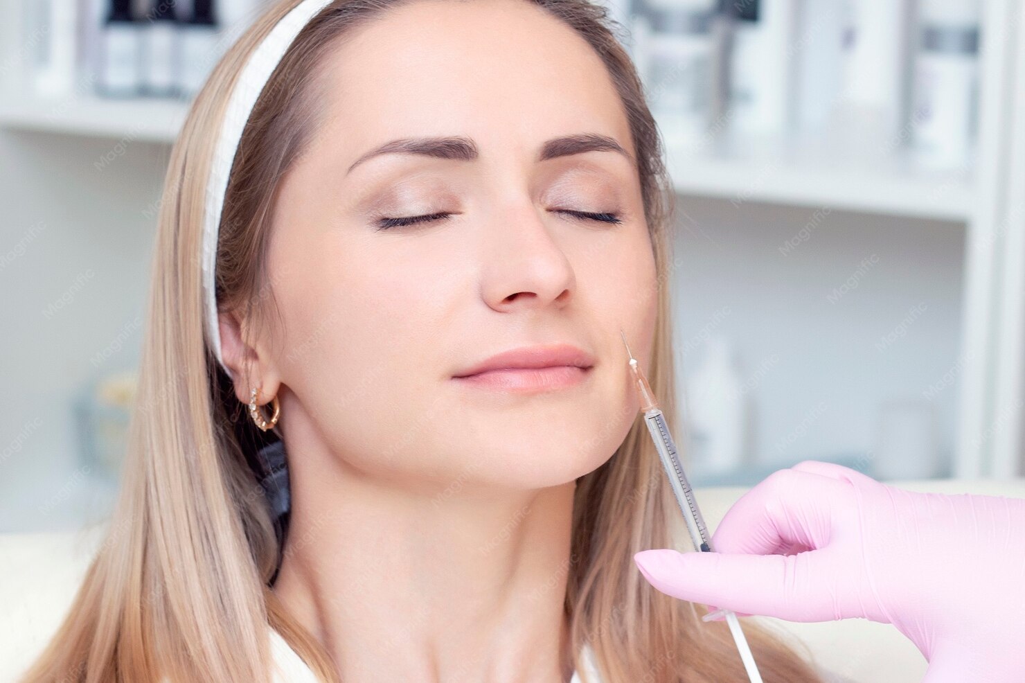 Midface Filler (Cheek Filler) Why the Midface Comes First