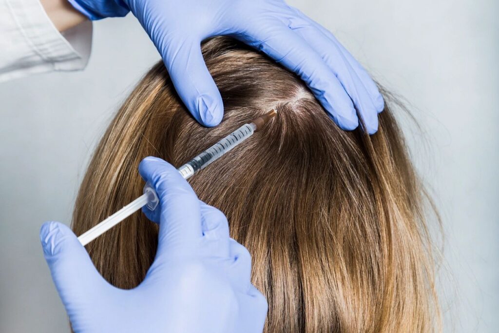 scalp hair injection treatment